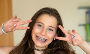 Girl With Braces